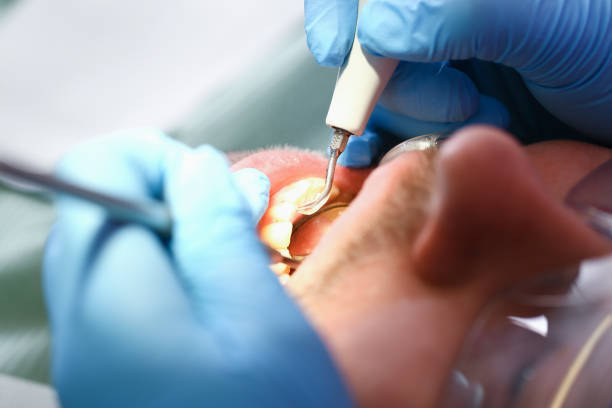 Best Cosmetic Emergency Dentistry in Angier, NC